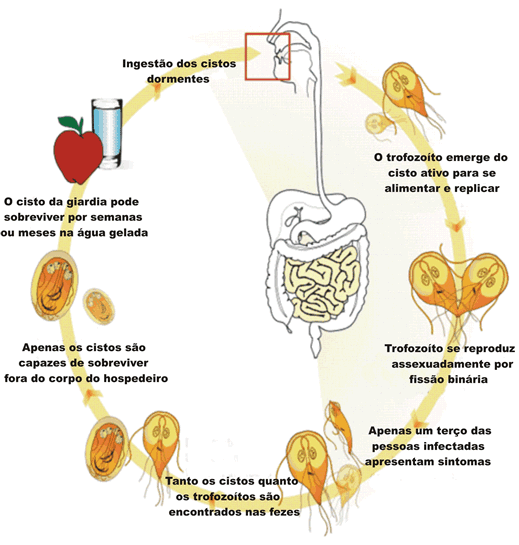a giardiasis extraintestinalis formája