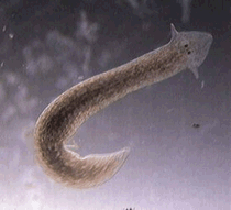 A platyhelminthes lárva stádiumai, Trichuriasis